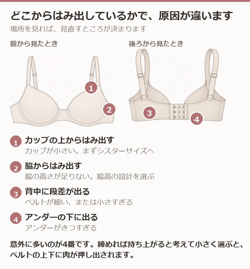 はみ肉が出る場所ごとに原因が違うことを示した図