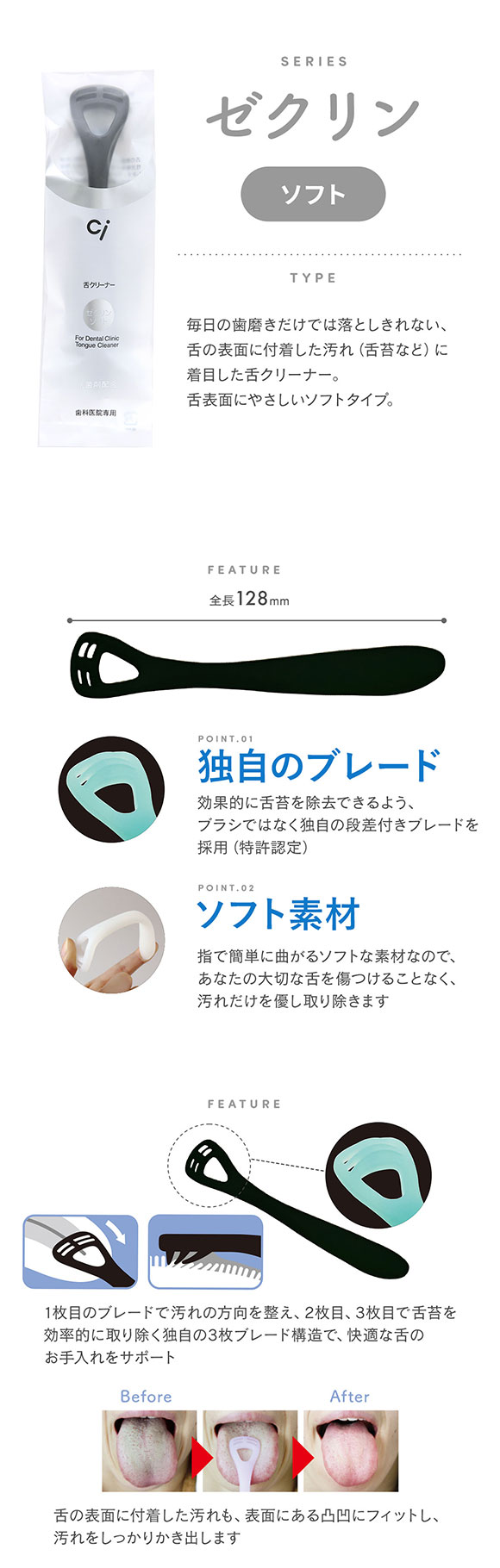 ゼクリン ソフト 舌クリーナー ブラック 4本入 口臭予防